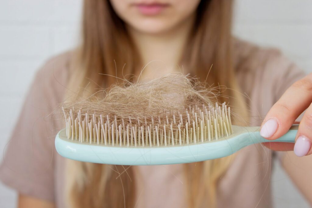 Queda de cabelo. Pessoa segurando uma escova de pentear com alguns fios de cabelo sobre ela.